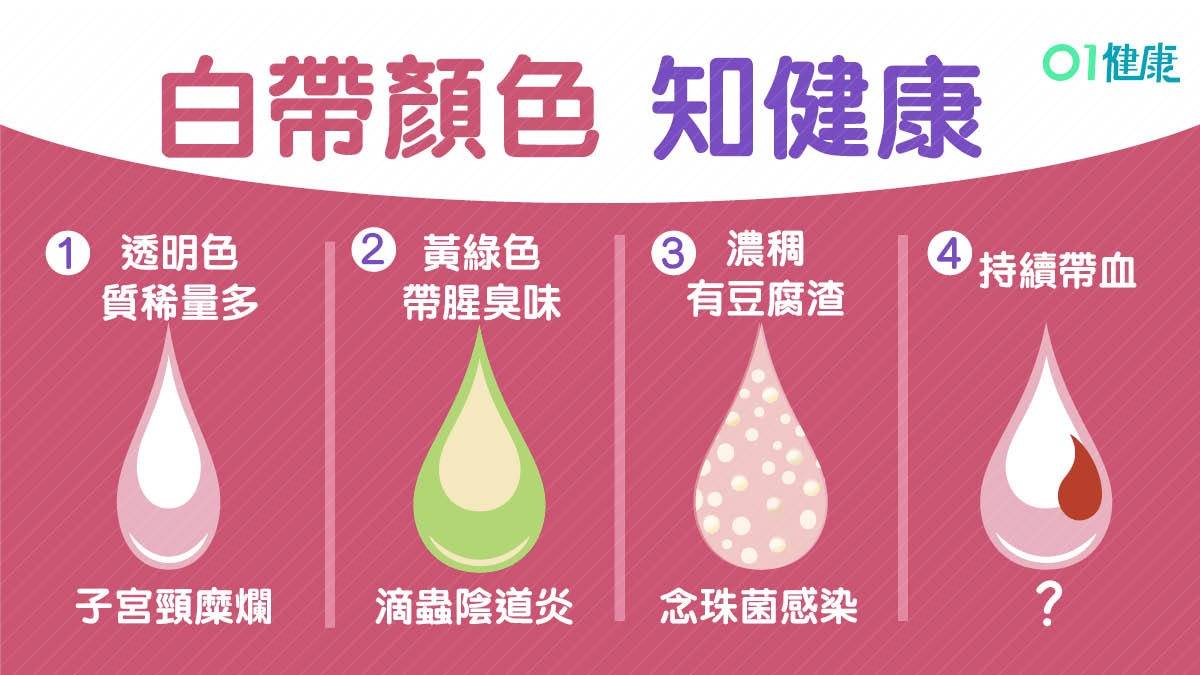 白带像豆腐渣是什么原因，豆腐渣样白带图片