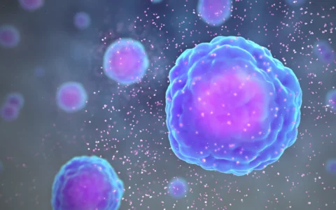 如何分辨黑色素瘤和普通痣？