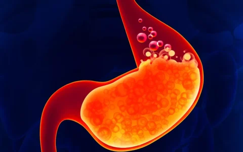 胃胀气怎么办？缓解胃胀气7大妙招